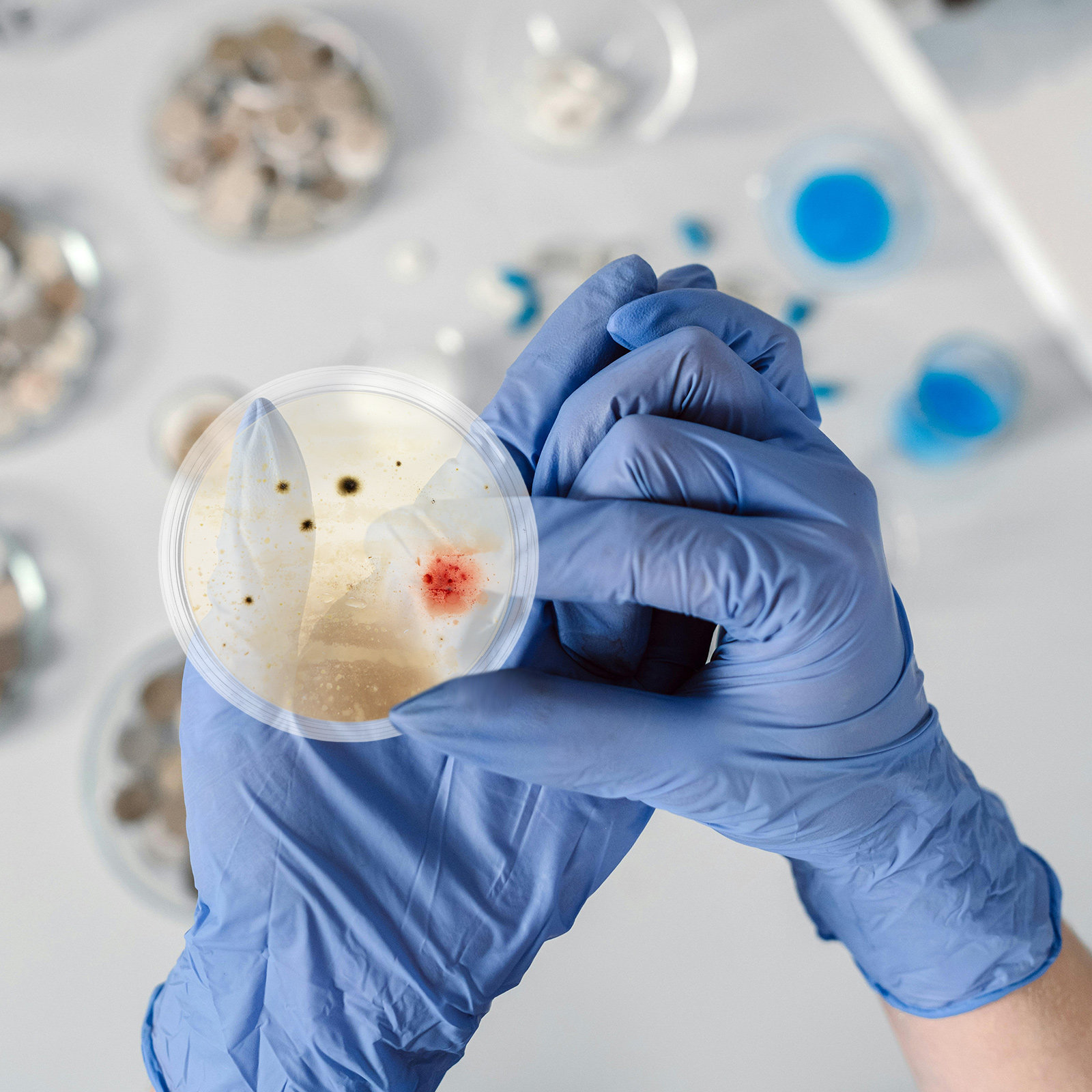 10 Pcs Agar Plates Tissue Cult - Agar Tissue Culture 评论和价格